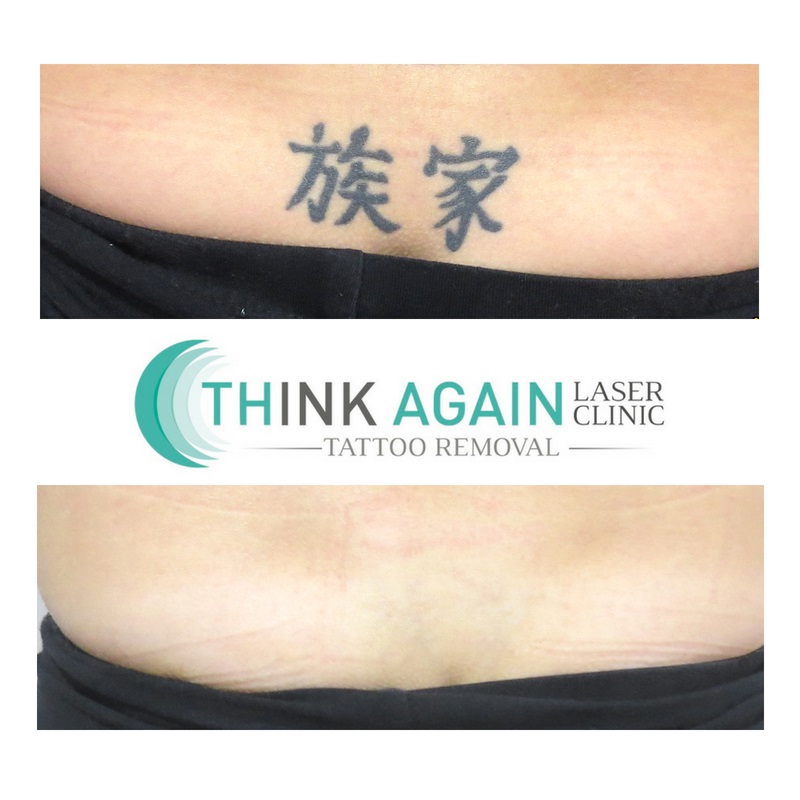 Think Again Laser Clinic – Auckland